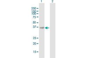 Western Blot analysis of QPCT expression in transfected 293T cell line by QPCT MaxPab polyclonal antibody. (QPCT 抗体  (AA 1-361))