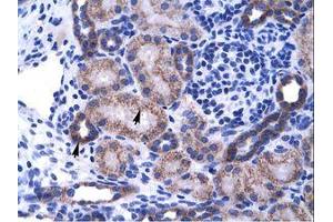 Image no. 1 for anti-Zinc Finger Protein 84 (ZNF84) (C-Term) antibody (ABIN202890) (ZNF84 抗体  (C-Term))