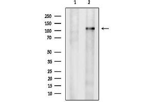 anti-CCR4-NOT Transcription Complex, Subunit 3 (CNOT3) (Internal Region) antibody