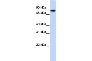WB Suggested Anti-GYS2 Antibody Titration:  0. (Glycogen Synthase 2 抗体  (Middle Region))