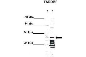 WB Suggested Anti-TARDBP Antibody  Positive Control: Lane 1: 5ug mouse brain cytoplasm Lane 2: 5ug mouse brain nucleus  Primary Antibody Dilution :  1:1000 Secondary Antibody : Anti rabbit - IR-dye Secondry Antibody Dilution :  1:10,000  Submitted by: Anonymous (TARDBP 抗体  (N-Term))