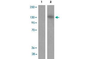 Western blot analysis of Lane 1: antigen-specific peptide treated JK cells, Lane 2: JK cells with MAP3K1 (phospho T1400) polyclonal antibody  .