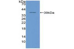 Detection of Recombinant NFkB, Human using Polyclonal Antibody to Nuclear Factor Kappa B (NFkB) (NFkB 抗体  (AA 42-367))