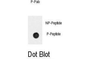 Dot blot analysis of anti-Phospho-BAR2-p Antibody (ABIN389931 and ABIN2839749) on nitrocellulose membrane. (BAR2 抗体  (pSer261))