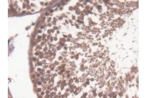 Immunohistochemistry (IHC) image for anti-Calcium/calmodulin-Dependent Protein Kinase II alpha (CAMK2A) (AA 1-478) antibody (ABIN7435484)