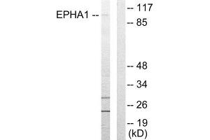Western Blotting (WB) image for anti-Ephrin Type A Receptor 1 (EPHA1) (Internal Region) antibody (ABIN1849247) (EPHA1 抗体  (Internal Region))