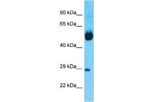 Host:  Rabbit  Target Name:  NR1H4  Sample Tissue:  Human Lung Tumor  Antibody Dilution:  1ug/ml (NR1H4 抗体  (N-Term))