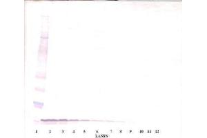 Image no. 3 for anti-Epidermal Growth Factor (EGF) antibody (ABIN465058) (EGF 抗体)
