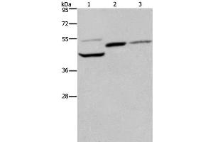 Western Blot analysis of Mouse heart, kidney and liver tissue using CYR61 Polyclonal Antibody at dilution of 1:350 (CYR61 抗体)