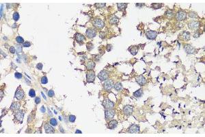 Immunohistochemistry of paraffin-embedded Rat testis using ASZ1 Polyclonal Antibody at dilution of 1:100 (40x lens). (ASZ1 抗体)
