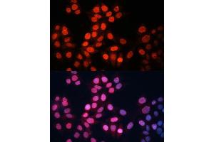 Immunofluorescence analysis of HeLa cells using GABPA Polyclonal Antibody (ABIN6127940, ABIN6140889, ABIN6140892 and ABIN6224475) at dilution of 1:100 (40x lens). (GABPA 抗体  (AA 1-260))