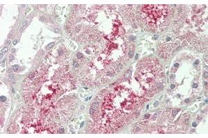 Detection of KLb in Human Kidney Tissue using Polyclonal Antibody to Klotho Beta (KLb) (Klotho beta 抗体  (AA 517-636))