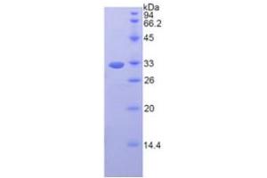 SDS-PAGE analysis of Mouse Fibrinogen gamma Protein. (FGG 蛋白)