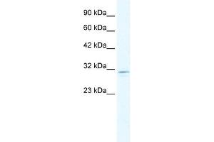 CLIC2 antibody used at 1. (CLIC2 抗体  (C-Term))