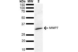 Western blot analysis of Rat kidney lysate showing detection of ~28 kDa MMP7 protein using Rabbit Anti-MMP7 Polyclonal Antibody (ABIN5651234). (MMP7 抗体  (AA 257-267) (Alkaline Phosphatase (AP)))
