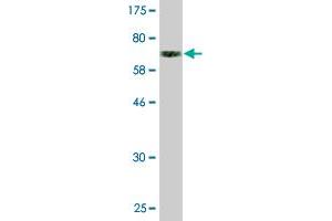 Western Blot detection against Immunogen (74. (GFR 抗体  (AA 1-444))