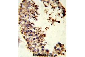 Formalin-fixed and paraffin-embedded human testis tissue reacted with ACR Antibody (Center), which was peroxidase-conjugated to the secondary antibody, followed by DAB staining. (Acrosin 抗体  (Middle Region))