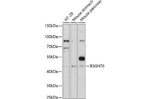 Western blot analysis of extracts of various cell lines, using B3GNT6 antibody (ABIN7271206) at 1:1000 dilution. (B3GNT6 抗体  (AA 30-200))