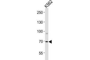 Western Blotting (WB) image for anti-Forkhead Box K1 (Foxk1) antibody (ABIN3004358) (Foxk1 抗体)