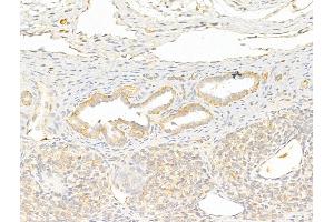 ABIN6255935 and ABIN6267312 at 1/100 staining Rat ovary tissue by IHC-P. (LCK 抗体  (pTyr505))