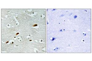 Immunohistochemistry analysis of paraffin-embedded human brain tissue, using TIP60 antibody. (KAT5 抗体  (Internal Region))