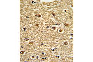 Immunohistochemistry (IHC) image for anti-Ets Variant 4 (ETV4) antibody (ABIN3002727) (ETV4 抗体)