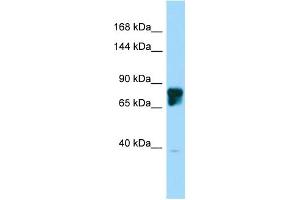 Host: Rabbit Target Name: SLITRK4 Sample Type: 721_B Whole Cell lysates Antibody Dilution: 1. (SLITRK4 抗体  (C-Term))