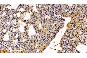 Immunohistochemistry (IHC) image for anti-Pyruvate Kinase M2 (PKM2) (AA 294-470) antibody (ABIN7438913)
