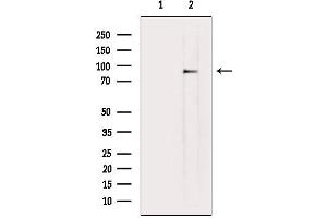anti-Fms-Related tyrosine Kinase 3 (FLT3) (C-Term) antibody