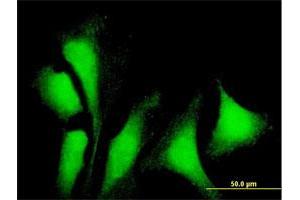 Immunofluorescence of purified MaxPab antibody to G3BP1 on HeLa cell. (G3BP1 抗体  (AA 1-466))