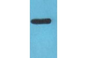 Western blot analysis on COLO205 cell lysate using Claudin 3 Antibody (Claudin 3 抗体  (C-Term))