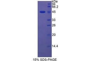 SDS-PAGE analysis of Rat Lipocalin 5 Protein. (LCN5 蛋白)