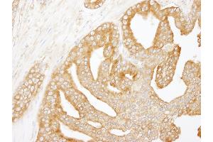 Immunohistochemistry (IHC) image for anti-Coronin, Actin Binding Protein, 1B (CORO1B) (AA 450-489) antibody (ABIN7448943)