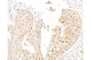 Immunohistochemistry (IHC) image for anti-Mediator Complex Subunit 1 (MED1) (C-Term) antibody (ABIN7453585) (MED1 抗体  (C-Term))