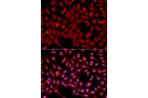 Immunofluorescence analysis of U2OS cell using SIAH1 antibody. (SIAH1 抗体  (AA 1-313))