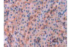 Immunohistochemistry (IHC) image for anti-Nitric Oxide Synthase Trafficker (NOSTRIN) (AA 1-245) antibody (ABIN7432256)