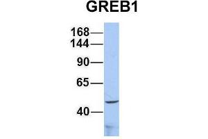 Host:  Rabbit  Target Name:  GREB1  Sample Type:  293T  Antibody Dilution:  1. (GREB1 抗体  (Middle Region))