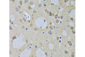 Immunohistochemistry of paraffin-embedded Mouse brain using YWHAZ Polyclonal Antibody at dilution of 1:100 (40x lens). (14-3-3 zeta 抗体)