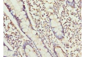 Immunohistochemistry of paraffin-embedded human small intestine tissue using ABIN7168462 at dilution of 1:100 (RUFY1 抗体  (AA 439-708))