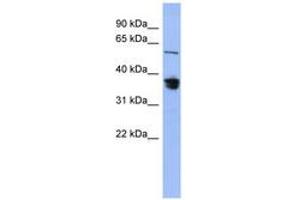 Image no. 1 for anti-RAD23 Homolog B (RAD23B) (AA 287-336) antibody (ABIN6744089) (RAD23B 抗体  (AA 287-336))