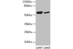 Western blot All lanes: NOSTRIN antibody at 6 μg/mL Lane 1: Mouse heart tissue Lane 2: Mouse brain tissue Secondary Goat polyclonal to rabbit IgG at 1/10000 dilution Predicted band size: 58, 55, 49, 65 kDa Observed band size: 58 kDa (NOSTRIN 抗体  (AA 1-322))