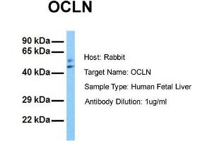 Host: Rabbit Target Name: OCLN Sample Tissue: Human Fetal Liver Antibody Dilution: 1. (Occludin 抗体  (N-Term))