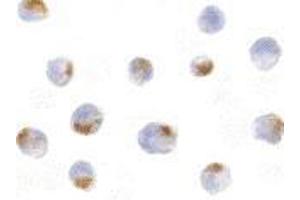 Immunocytochemistry of Acinus in K562 cells with AP30012PU-N Acinus antibody at 5 μg/ml. (ACIN1 抗体  (Intermediate Domain))