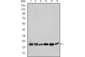 Western blot analysis using BID mouse mAb against Hela (1), A431 (2), Jurkat (3), A549 (4), HepG2 (5), and HEK293 (6) cell lysate. (BID 抗体)