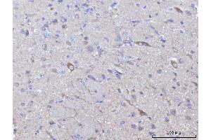 IHC analysis of Nedd4 using anti-Nedd4 antibody (ABIN7602341).