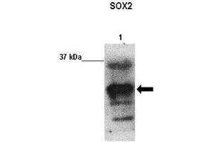 Western Blotting (WB) image for anti-SRY (Sex Determining Region Y)-Box 2 (SOX2) (N-Term) antibody (ABIN2777428)
