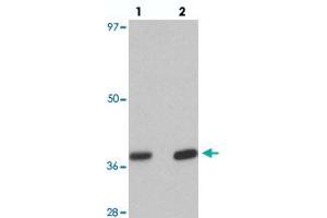 Western blot analysis of EI24 in rat liver tissue with EI24 polyclonal antibody  at (lane 1) 1 and (lane 2) 2 ug/mL. (EI24 抗体  (C-Term))