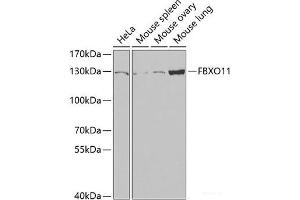 Western blot analysis of extracts of various cell lines using FBXO11 Polyclonal Antibody at dilution of 1:1000. (FBXO11 抗体)
