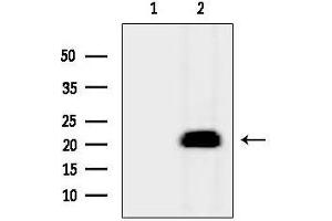 Western blot analysis of lysates from Mouse liver, using MYL12A Antibody.