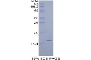SDS-PAGE analysis of Human Diamine Oxidase Protein. (DAO 蛋白)
